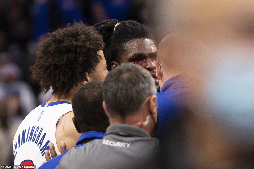 20 man fight erupts as LeBron James is ejected for giving shocking elbow to face of Isaiah Stewart during NBA game(Photos/Videos)