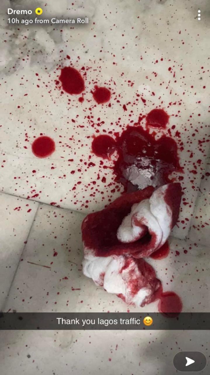  Rapper Dremo and his friends attacked by robbers in Lagos traffic