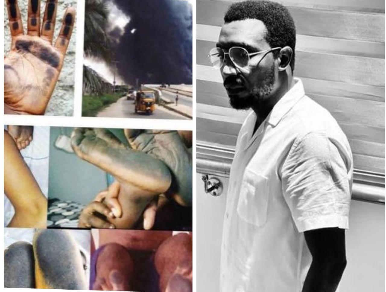 "Let?s not sit back and keep quiet" - Singer Timi Dakolo raises alarm over surge of black soot in Port Harcourt