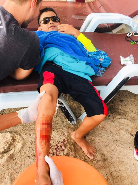 Brave boy, 8, survives shark attack by punching the creature in the face