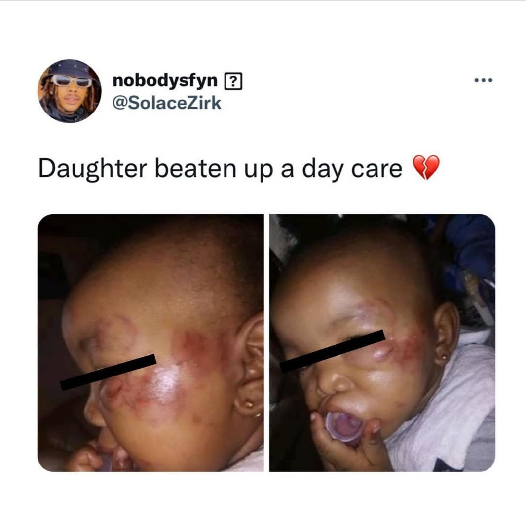 Outrage as Twitter user shares photo of a little girl