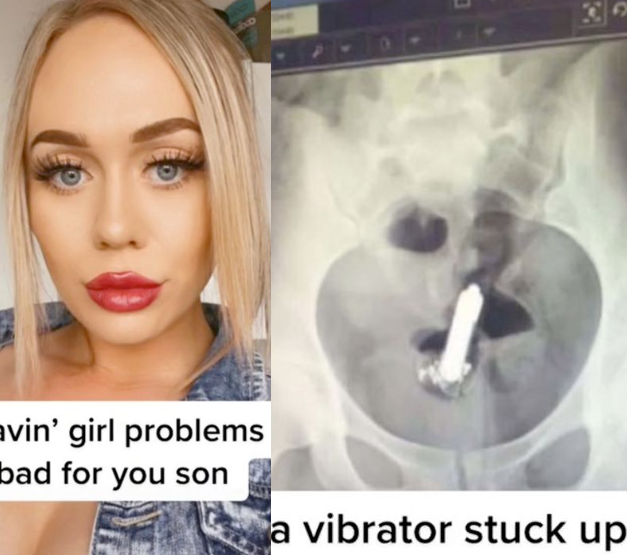 Woman tells of her embarrassment after vibrator got stuck up her bum and she needed surgery to remove it
