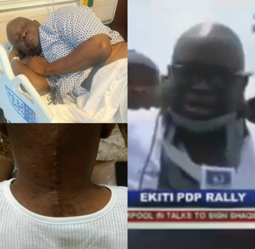 Former Ekiti state governor, Ayo Fayose, undergoes surgery (photos/video)