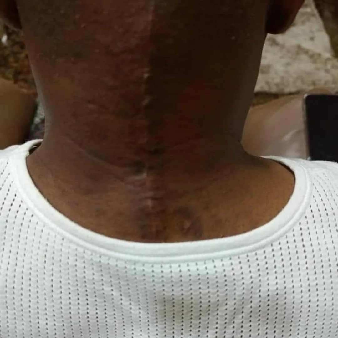 Former Ekiti state governor, Ayo Fayose, undergoes surgery (photos/video)