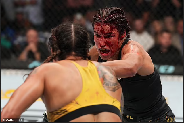 Female UFC fighter, Julianna Pena is rushed to hospital and taken to see a plastic surgeon after losing a 