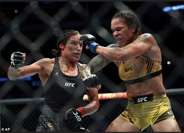 Female UFC fighter, Julianna Pena is rushed to hospital and taken to see a plastic surgeon after losing a 