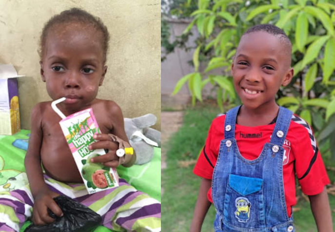 Akwa Ibom boy, Hope reunites with his father six years after he was branded a witch, stigmatized and left to starve to death 