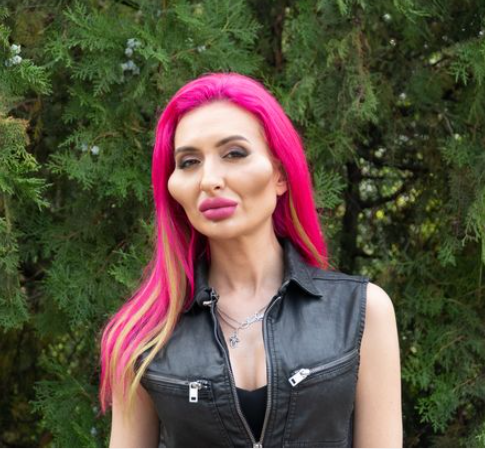 Woman with ?world?s biggest cheeks? shares photo?taken six years ago to show what she looked like before surgery