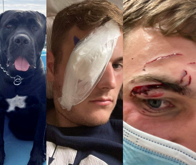 Hero saves drowning dog only to be immediately bitten by the dog