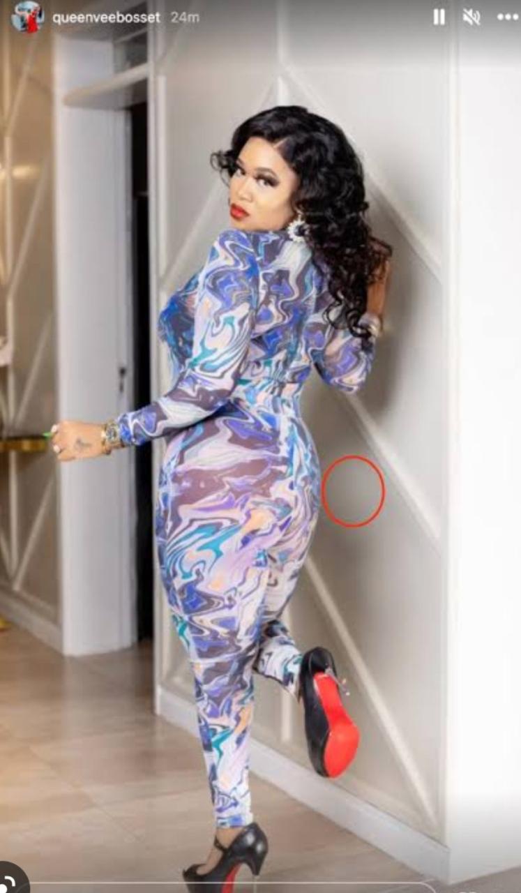 "I was given a second chance" Vera Sidika begs women again to avoid cosmetic surgery as she shares video from her reconstructive surgery experience 