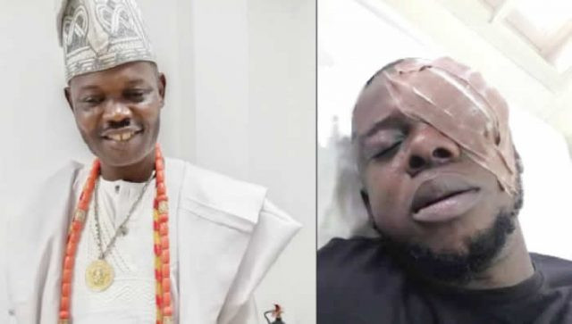 Ogun monarch allegedly blinds trader for dancing with his queen at a birthday party