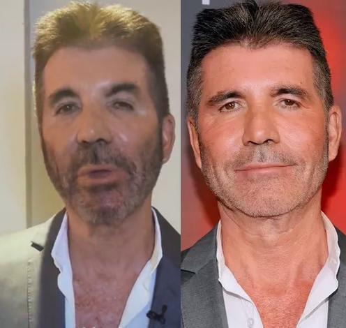 Simon Cowell trolled as his new looks sparks concern (video)