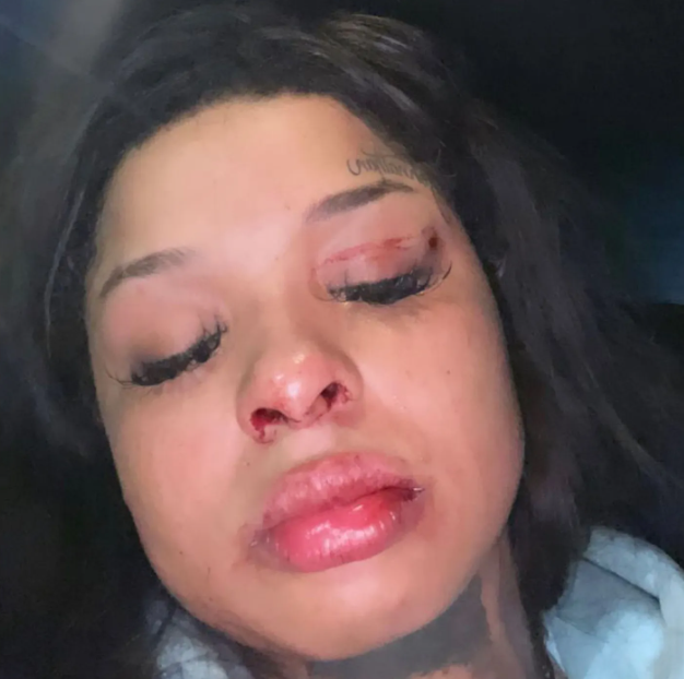 Chrisean Rock shows off black eye she allegedly gave rapper Blueface (video)