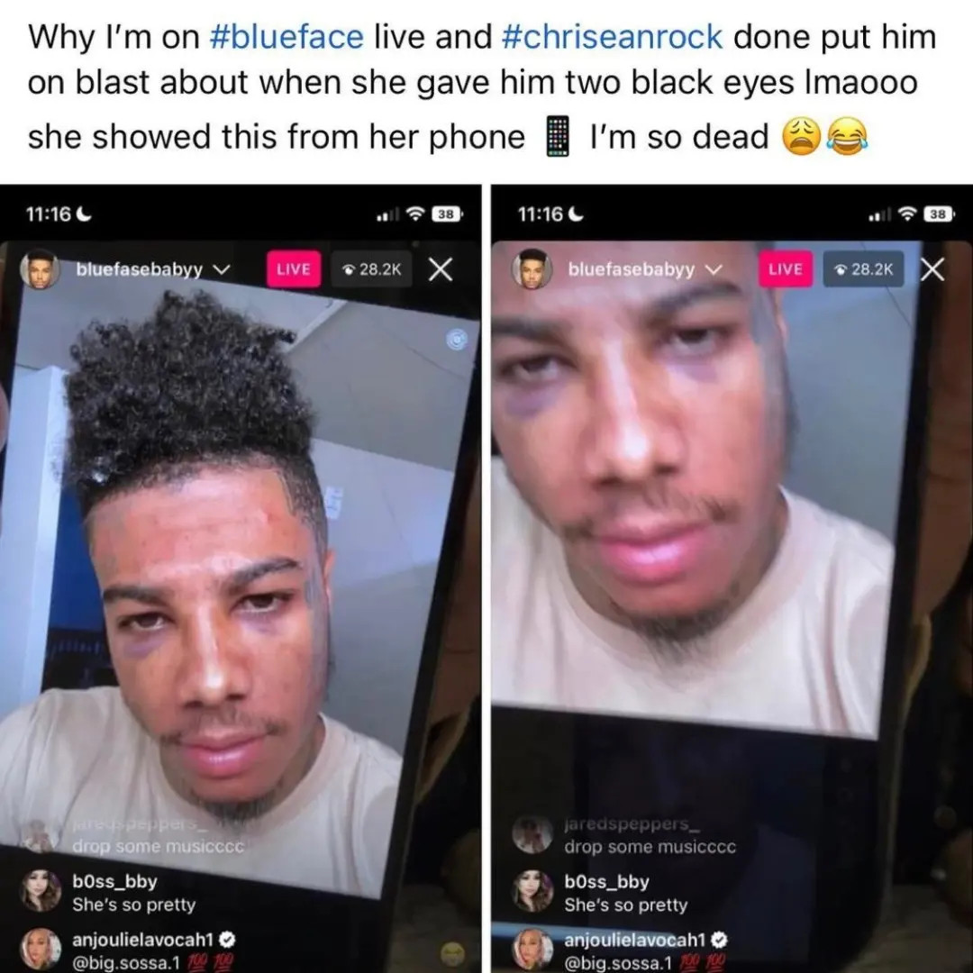 Chrisean Rock shows off black eye she allegedly gave rapper Blueface (video)
