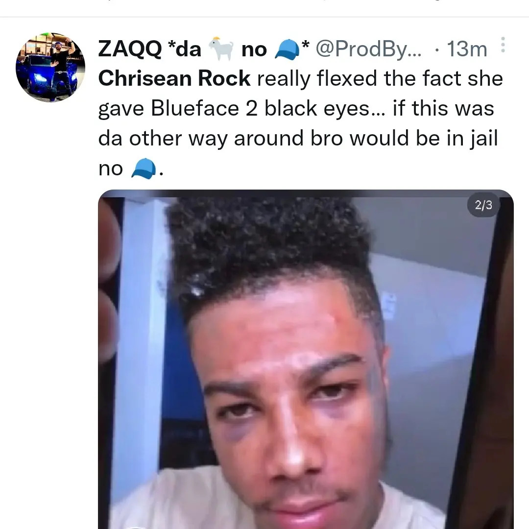 Chrisean Rock shows off black eye she allegedly gave rapper Blueface (video)