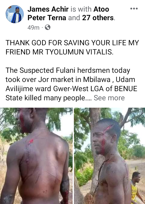 Scores reportedly killed, others injured as suspected Fulani herdsmen attack market in Benue village