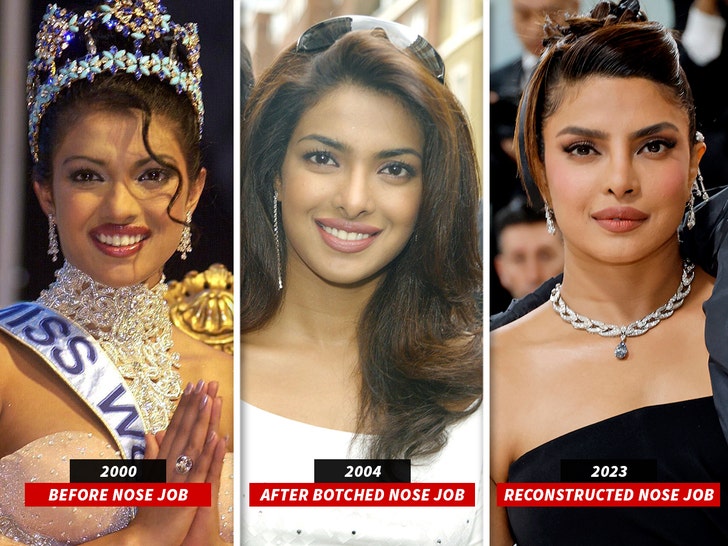 Priyanka Chopra reveals she fell into depression after botched nose job