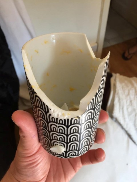 Mum left with skin peeling off her face after egg exploded during TikTok challenge