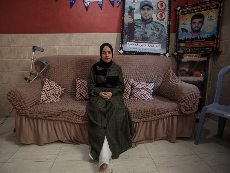 A girl injured in her leg