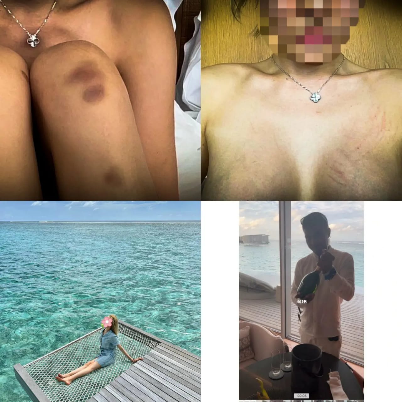 Chinese lady recounts how she was raped by her butler in a hotel in Maldives