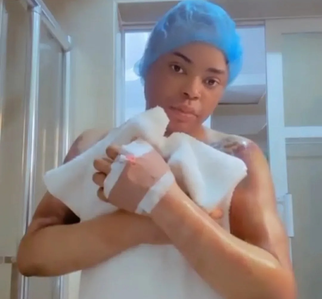 Bobrisky shows off his newly acquired butt (video)
