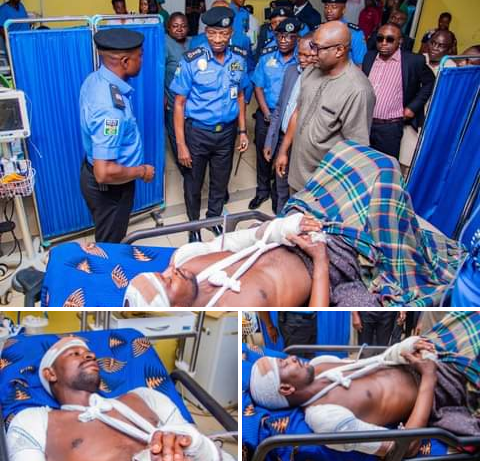 IGP visits police inspector brutally attacked and macheted by armed hoodlums in Abuja (graphic video)