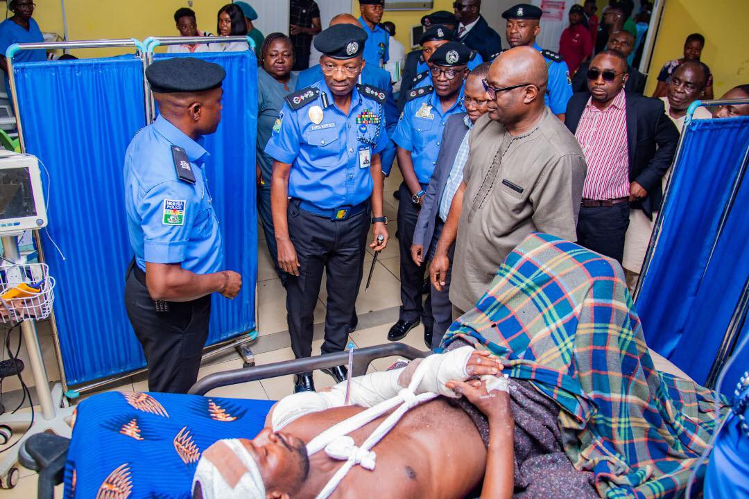 IGP visits police inspector brutally attacked and macheted by armed hoodlums in Abuja (graphic video)