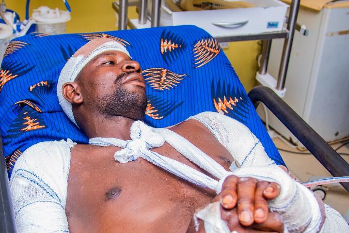 IGP visits police inspector brutally attacked and macheted by armed hoodlums in Abuja (graphic video)