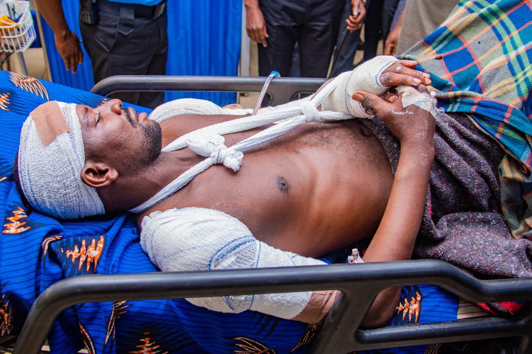 IGP visits police inspector brutally attacked and macheted by armed hoodlums in Abuja (graphic video)